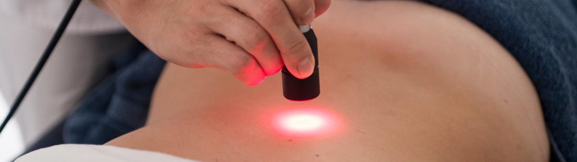 epilazione laser a diodi